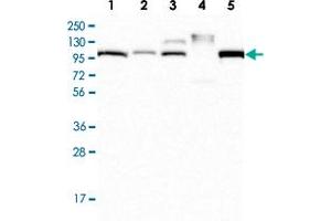 Western Blot analysis of Lane 1: RT-4 cell lysate, Lane 2: U-251 MG, Lane 3: Human plasma, Lane 4: Human Liver tissue, Lane 5: Human Tonsil tissue with APOB polyclonal antibody  at 1:250 - 1:500 dilution. (APOB antibody)