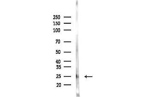anti-Transmembrane Protein 9 (TMEM9) (N-Term) antibody
