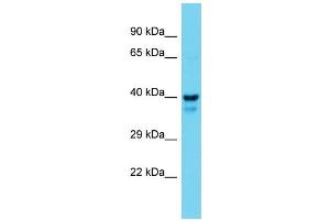 Western Blotting (WB) image for anti-Mitogen-Activated Protein Kinase Kinase 1 (MAP2K1) (N-Term) antibody (ABIN2788667) (MEK1 antibody  (N-Term))
