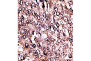 Image no. 2 for anti-Melanoma Antigen Family C, 1 (MAGEC1) (C-Term) antibody (ABIN358656) (MAGEC1 antibody  (C-Term))