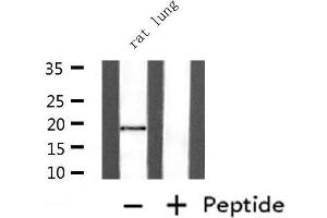 Western blot analysis of extracts from rat lung , using UBE2I  Antibody. (UBE2I antibody  (N-Term))