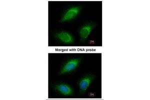 ICC/IF Image Immunofluorescence analysis of paraformaldehyde-fixed HeLa, using RGL2, antibody at 1:200 dilution. (RGL2 antibody)