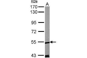 RORA antibody