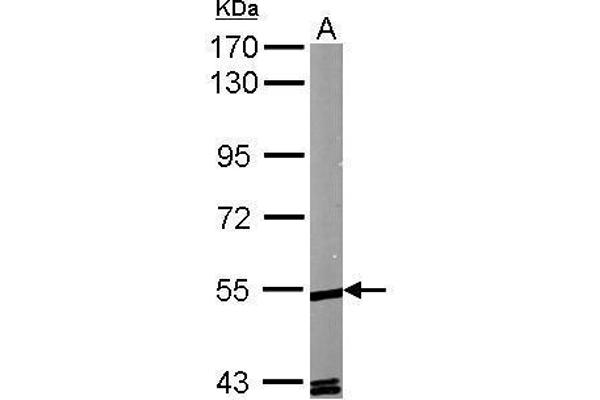 RORA antibody