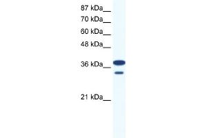 WB Suggested Anti-LHX3 Antibody Titration:  0. (LHX3 antibody  (Middle Region))