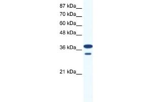 WB Suggested Anti-LHX3 Antibody Titration:  0.