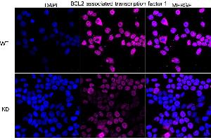 Immunocytochemical staining of HeLa cells using BCL2 associated transcription factor 1 antibody (ABIN7797747), 1:1,000), Top panel: wild-type (WT), Bottom panal: BCL2 associated transcription factor 1 shRNA knockdown (KD).
