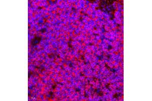 Immunofluorescence of paraffin embedded mouse splenitis using CCR2 (ABIN7073453) at dilution of 1:800 (400x lens)
