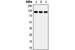 Western blot analysis of Apolipoprotein E Receptor 2 expression in MCF7 (A), NIH3T3 (B), H9C2 (C) whole cell lysates.