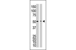 The PSEN1 polyclonal antibody  is used in Western blot to detect PSEN1 in mouse kidney tissue lysate (lane 1) and HL-60 cell lysate (lane 2) lysate.