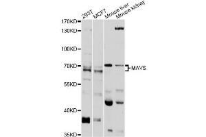 Western blot analysis of extracts of various cell lines, using MAVS antibody (ABIN5973386) at 1/1000 dilution. (MAVS antibody)