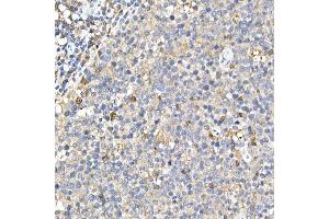 Immunohistochemistry of paraffin-embedded rat stomach using Phospho--S473 Rabbit mAb (ABIN6135179, ABIN6135970, ABIN6135971 and ABIN7101880) at dilution of 1:100 (40x lens). (AKT1 antibody  (pSer473))