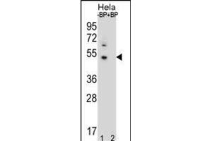 Western blot analysis of DNAJB6 Antibody (Center) Pab (ABIN656424 and ABIN2845716) pre-incubated without(lane 1) and with(lane 2) blocking peptide in Hela cell line lysate.