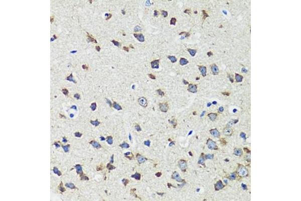 CCDC124 antibody  (AA 1-223)