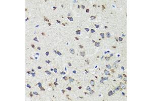 Immunohistochemistry of paraffin-embedded mouse brain using CCDC124 antibody  at dilution of 1:100 (40x lens).