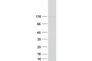 Western Blotting (WB) image for Phosphatidylinositol 4-Kinase, Catalytic, beta (PI4KB) protein (Myc-DYKDDDDK Tag) (ABIN2728878)