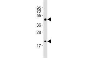 Western blot testing of Shh antibody at 1:2000 dilution + mouse stomach lysate; Predicted molecular weight: 45/27/19 kDa (1)