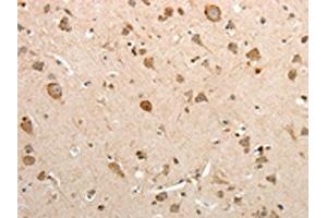 The image on the left is immunohistochemistry of paraffin-embedded Human brain tissue using ABIN7131078(SLC12A1 Antibody) at dilution 1/15, on the right is treated with fusion protein. (SLC12A1 antibody)
