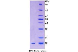 SDS-PAGE analysis of Human Oncomodulin Protein. (Oncomodulin Protein (OCM))