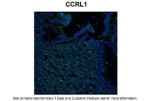 Sample Type: human colon tissues infected ex-vivo with HIV-1Green: PrimaryBlue: DAPIPrimary Dilution: 1:1000Secondary Antibody: Donkey anti-Rabbit AF 488Secondary Dilution: 1:500Image Submitted By: Chiara FoglieniSan Raffaele Scientific Institute, Milan, Italy (CCRL1 antibody  (C-Term))