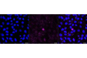 Immunocytochemical staining of H9c2 cells with Haptoglobin antibody (ABIN7798837), 1:1,000). (Recombinant Haptoglobin antibody)