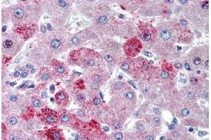 Human Liver (formalin-fixed, paraffin-embedded) stained with CCR10 antibody ABIN291274 at 5 ug/ml followed by biotinylated goat anti-rabbit IgG secondary antibody ABIN481713, alkaline phosphatase-streptavidin and chromogen. (CCR10 antibody  (AA 350-362))