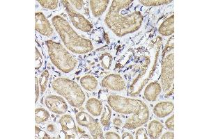 Immunohistochemistry of paraffin-embedded mouse kidney using METTL4 Rabbit pAb (ABIN6133091, ABIN6143773, ABIN6143774 and ABIN6224964) at dilution of 1:100 (40x lens). (METTL4 antibody  (AA 1-190))