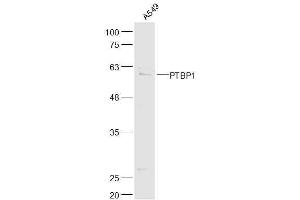 A549 lysates probed with PTBP1 Polyclonal Antibody, Unconjugated  at 1:500 dilution and 4˚C overnight incubation. (PTBP1 antibody  (AA 451-531))