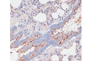 Immunohistochemistry of paraffin-embedded Rat lung using ZNRF3 Polyclonal Antibody at dilution of 1:100 (40x lens).