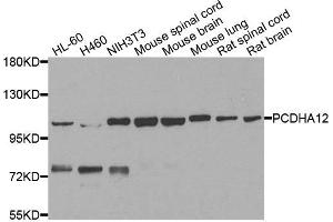 Western blot analysis of extracts of various cells, using PCDHA12 antibody. (PCDHA12 antibody)