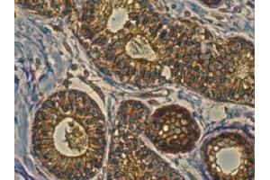 Immunohistochemistry (IHC) image for anti-RAB11A, Member RAS Oncogene Family (RAB11A) (C-Term) antibody (ABIN1440025) (RAB11A antibody  (C-Term))