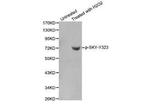 Western blot analysis of extracts from Jurkat cells using phospho-SYK-Y323 antibody. (SYK antibody  (pTyr323))