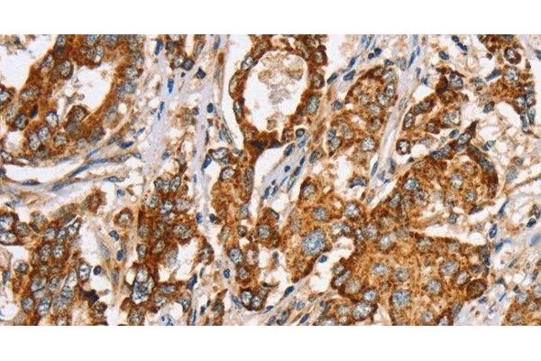 Solute Carrier Family 5 (Sodium/inositol Cotransporter), Member 11 (SLC5A11) antibody