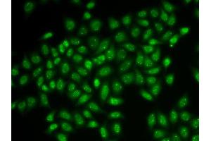 Immunofluorescence analysis of HeLa cell using COIL antibody. (Coilin antibody)