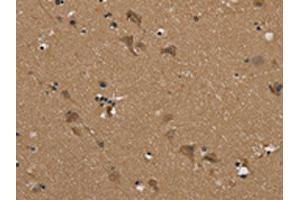 The image on the left is immunohistochemistry of paraffin-embedded Human brain tissue using ABIN7192079(PUS10 Antibody) at dilution 1/45, on the right is treated with synthetic peptide. (PUS1 antibody)