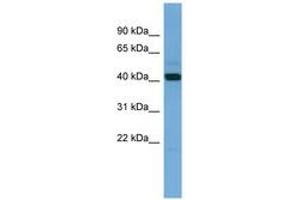 Image no. 1 for anti-Pyruvate Dehydrogenase (Lipoamide) alpha 2 (PDHa2) (AA 71-120) antibody (ABIN6745676) (PDHA2 antibody  (AA 71-120))