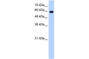 Western Blotting (WB) image for anti-Stress-Induced-phosphoprotein 1 (STIP1) antibody (ABIN2462951) (STIP1 antibody)
