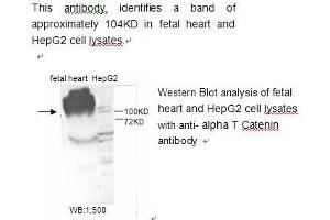 Image no. 1 for anti-Catenin (Cadherin-Associated Protein), alpha 1, 102kDa (CTNNA1) antibody (ABIN790787) (CTNNA1 antibody)