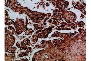 Immunohistochemical analysis of paraffin-embedded Human-placenta, antibody was diluted at 1:100 (NAIP antibody  (AA 1191-1240))