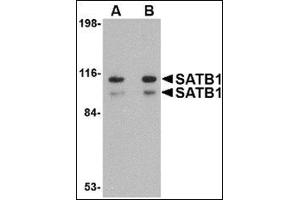Western blot analysis of SATB1 in SK-N-SH cell lysate with this product at (A) 1 and (B) 2 μg/ml.