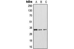 Western blot analysis of Arginase 1 expression in MCF7 (A), mouse liver (B), rat kidney (C) whole cell lysates. (Liver Arginase antibody  (Center))