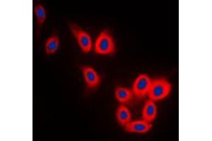 Immunofluorescent analysis of TAU staining in SKNSH cells. (tau antibody  (C-Term))