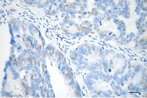 anti-Cyclin A2 (CCNA2) antibody