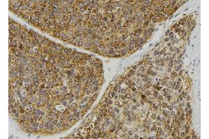ABIN6269391 at 1/100 staining Human pancreas tissue by IHC-P. (ASK1 antibody  (N-Term))