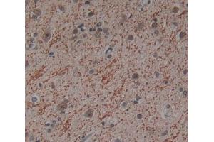 Used in DAB staining on fromalin fixed paraffin- embedded Kidney tissue (ICK antibody  (AA 1-284))