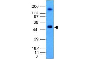 Western Blot Analysis of HCT116 cell lysate CAIX Mouse Monoclonal Antibody (CA9/781). (CA9 antibody)