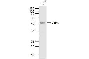 Mouse liver lysates probed with C1RL Polyclonal Antibody, Unconjugated  at 1:500 dilution and 4˚C overnight incubation. (C1RL antibody  (AA 101-200))