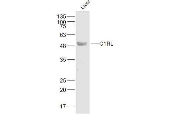 C1RL anticorps  (AA 101-200)