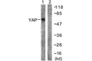 Western blot analysis of extracts from HepG2 cells, treated with Wortmannin 40nM 24h, using YAP (Ab-127) Antibody.