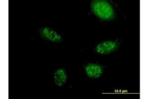 Immunofluorescence of purified MaxPab antibody to ZNF501 on HeLa cell.